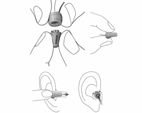 Micro auricolare RF
